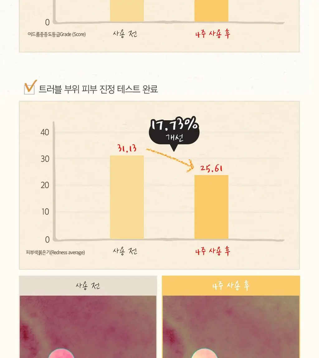 [끝판꿀광+트러블개선] 스킨푸드 로열허니 프로폴리스 인리치 에센스 상세페이지 19